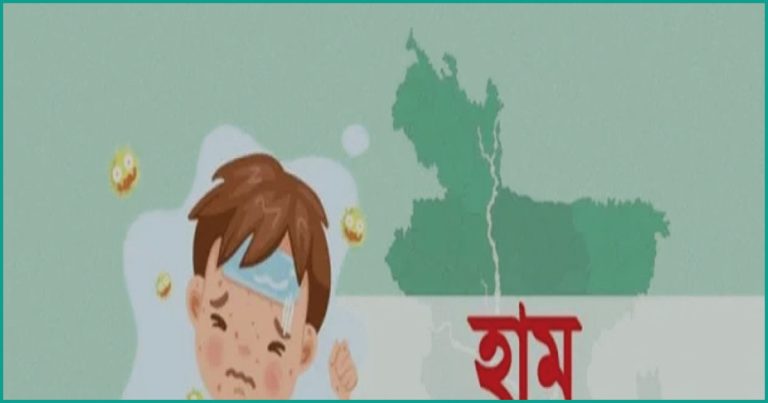 দেশে হামের উপসর্গে আরও ৮ শিশুর মৃত্যু